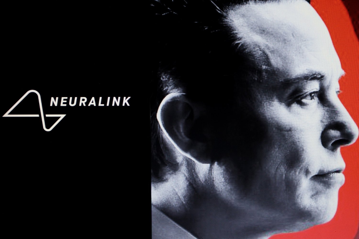 Chip Para La Ceguera De Neuralink