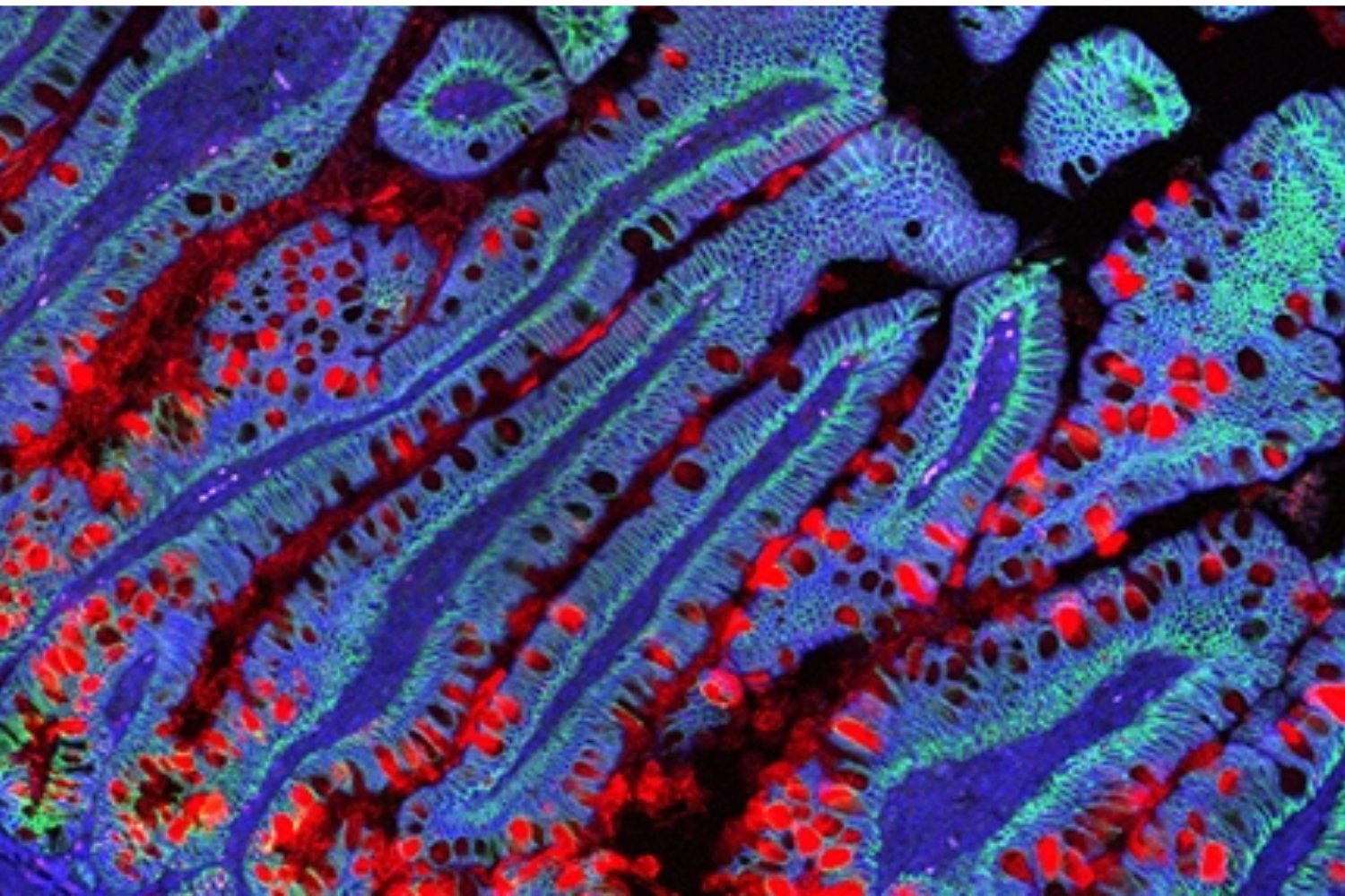 Cómo las células madre intestinales interactúan con el sistema inmune