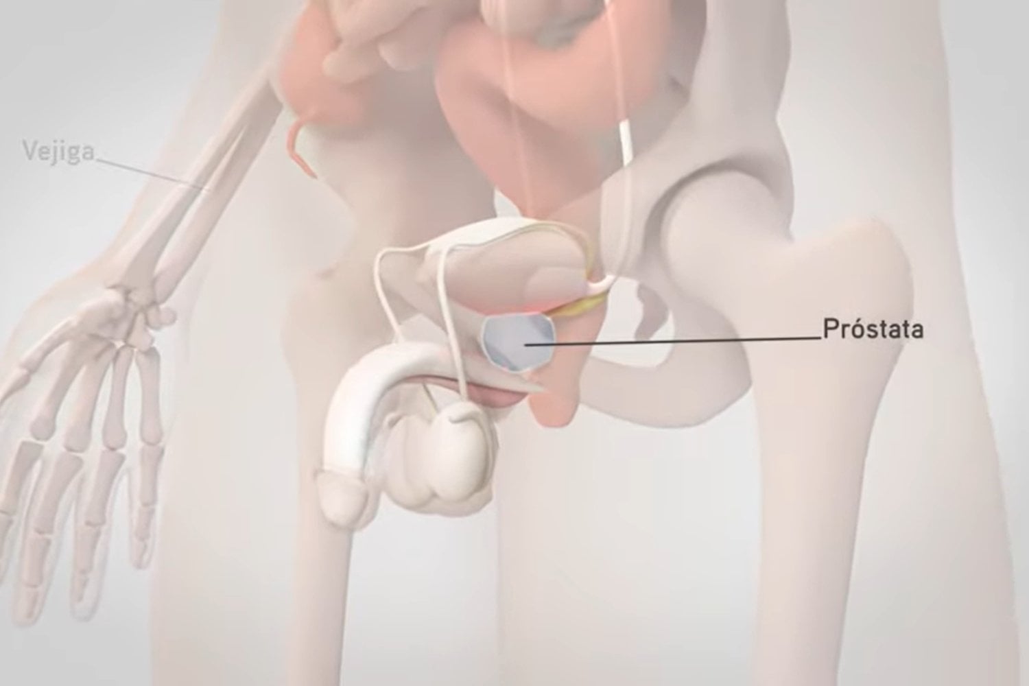 Nuevos avances en la detección del cáncer de próstata que prometen revolucionar los tratamientos