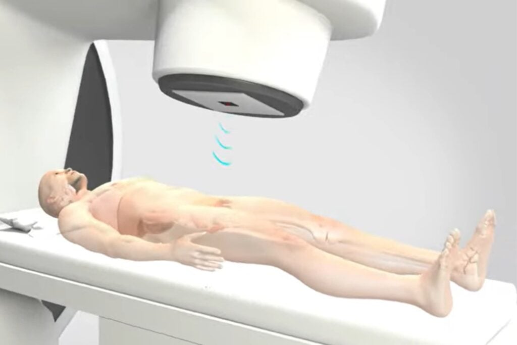 Nuevos avances en la detección del cáncer de próstata que prometen revolucionar los tratamientos