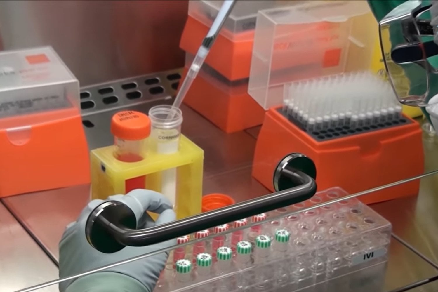 Nuevos avances en la detección del cáncer de próstata que prometen revolucionar los tratamientos