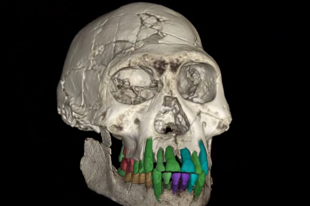 Fosil Dental Infancia Mas Larga