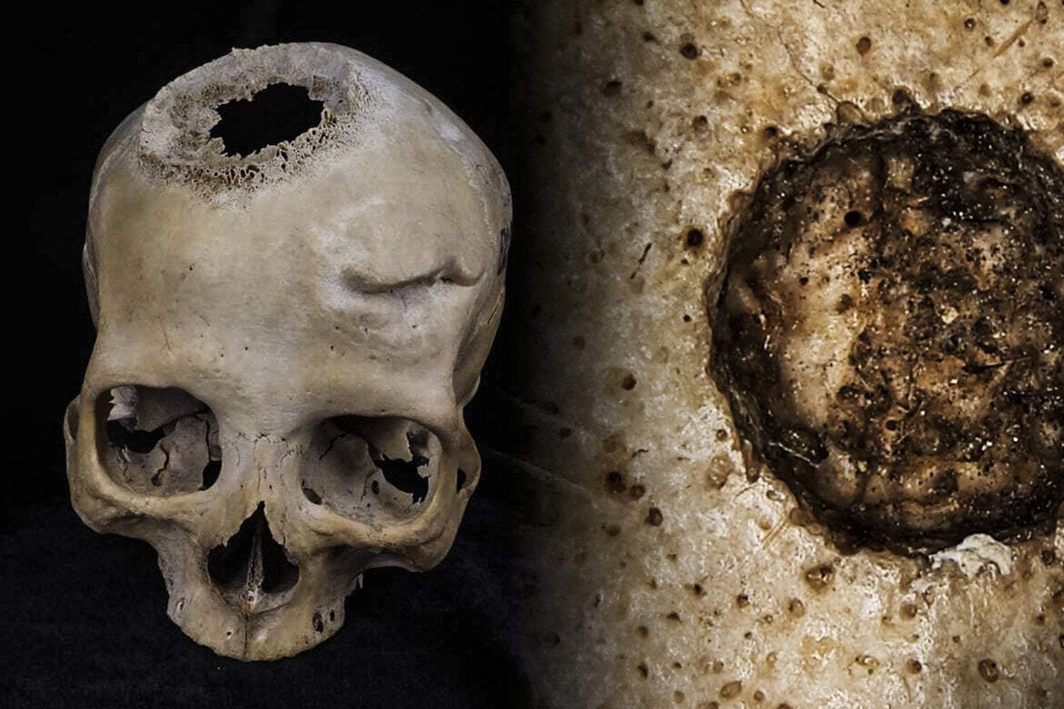 Las complejas cirugías cerebrales del Antiguo Egipto que sorprendieron al mundo