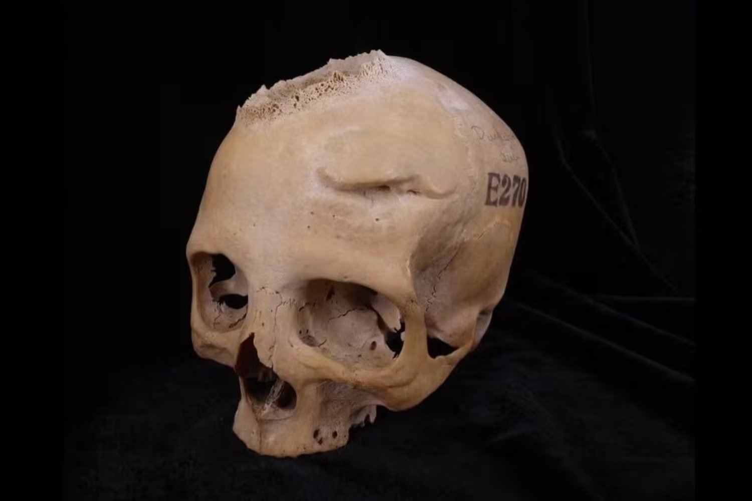 Los antiguos egipcios intentaron curar el cáncer hace 4.000 años: el método sorprendente