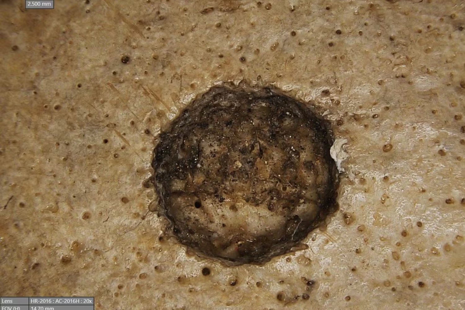 Los antiguos egipcios intentaron curar el cáncer hace 4.000 años: el método sorprendente