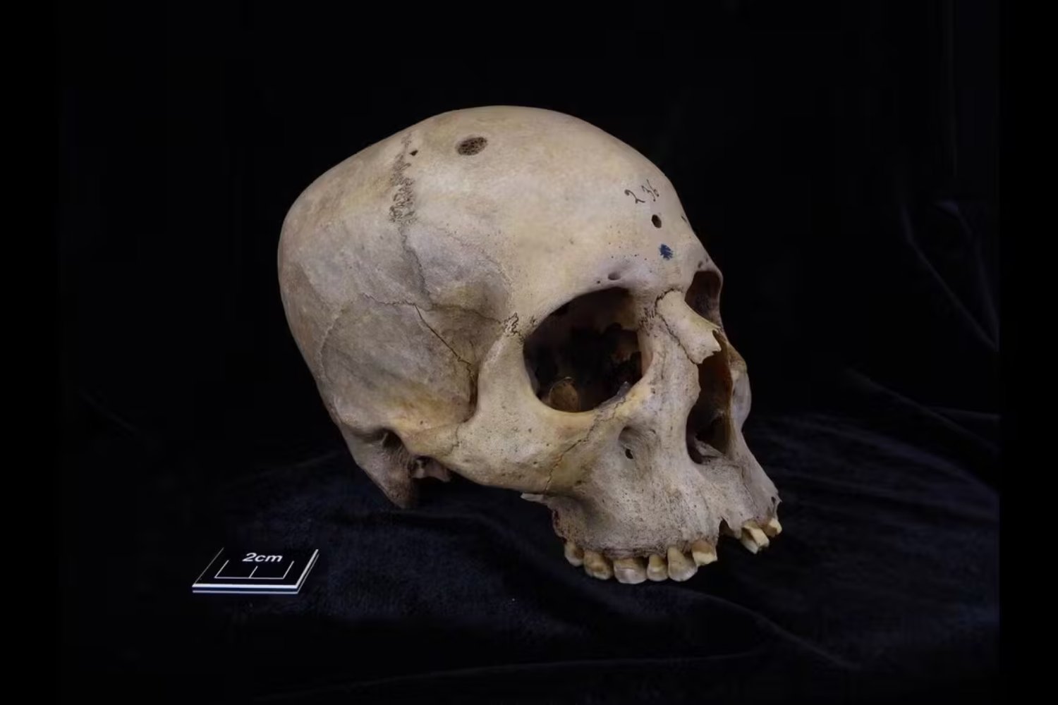 Los antiguos egipcios intentaron curar el cáncer hace 4.000 años: el método sorprendente