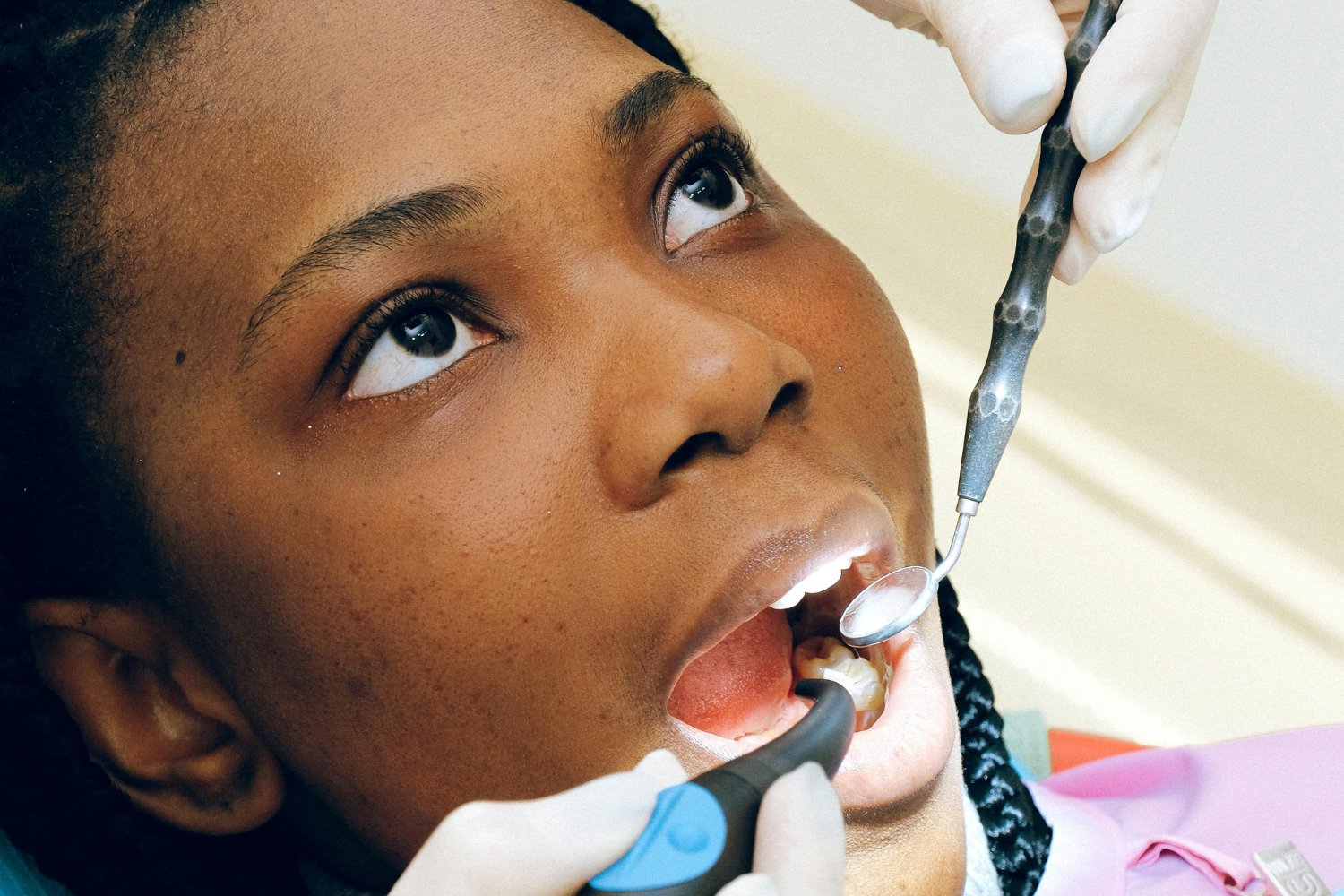 Eliminar Sarro De Los Dientes