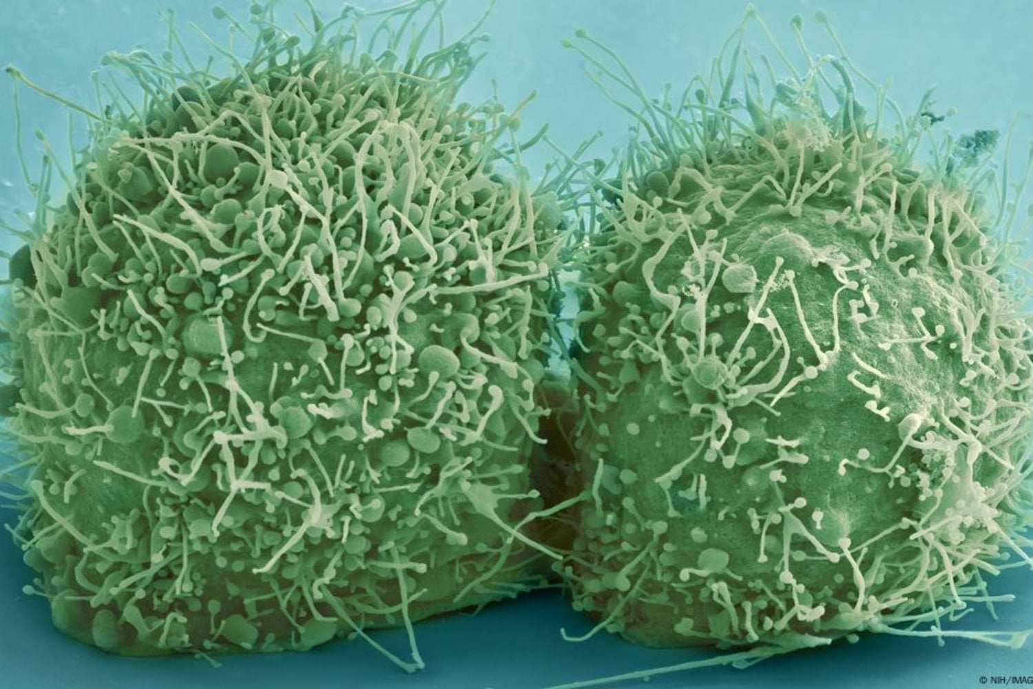 Ni vivo ni muerto: el inquietante hallazgo que desafía nuestra comprensión de la biología