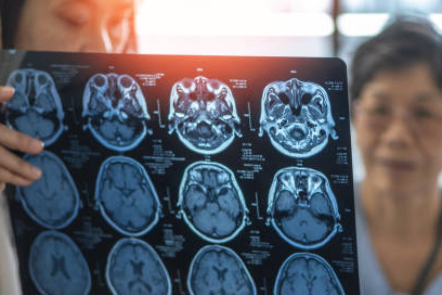 El sorprendente caso de un hombre que desafía al Alzheimer y deja perpleja a la ciencia