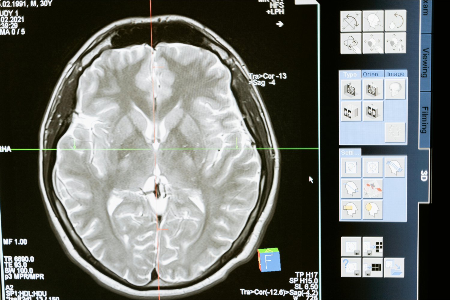 El sorprendente mecanismo oculto que activa tu cerebro al correr un maratón