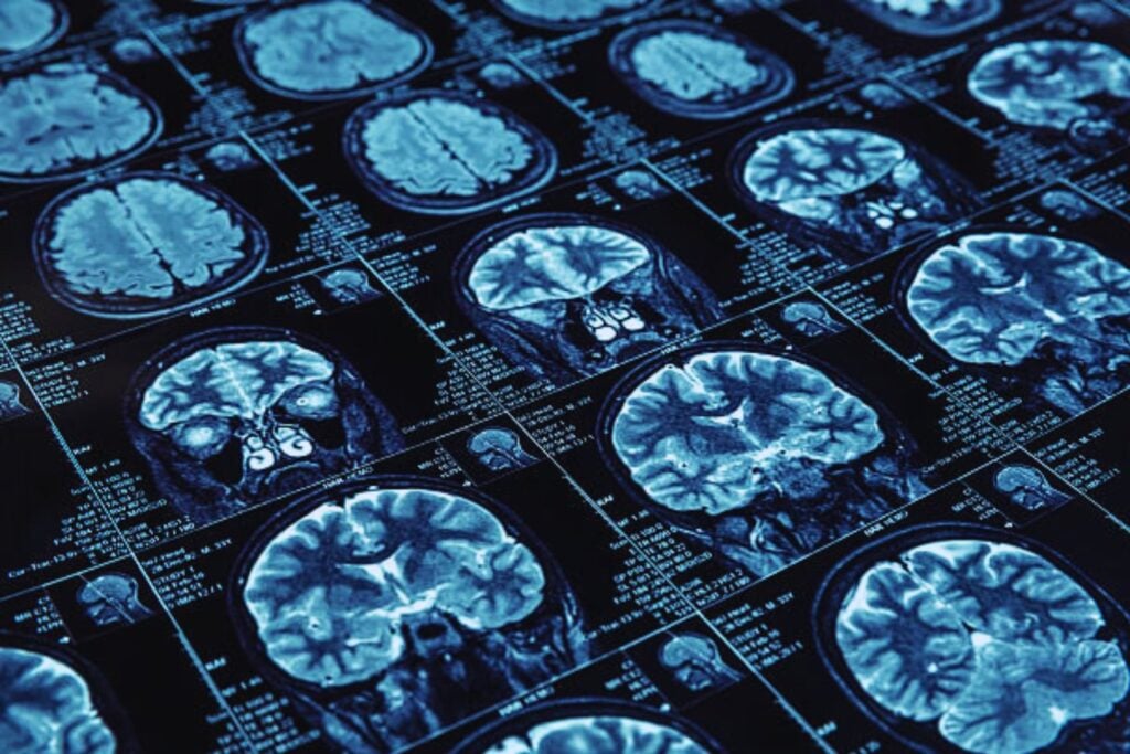 El hongo que promete regenerar neuronas y mejorar la memoria, según la ciencia