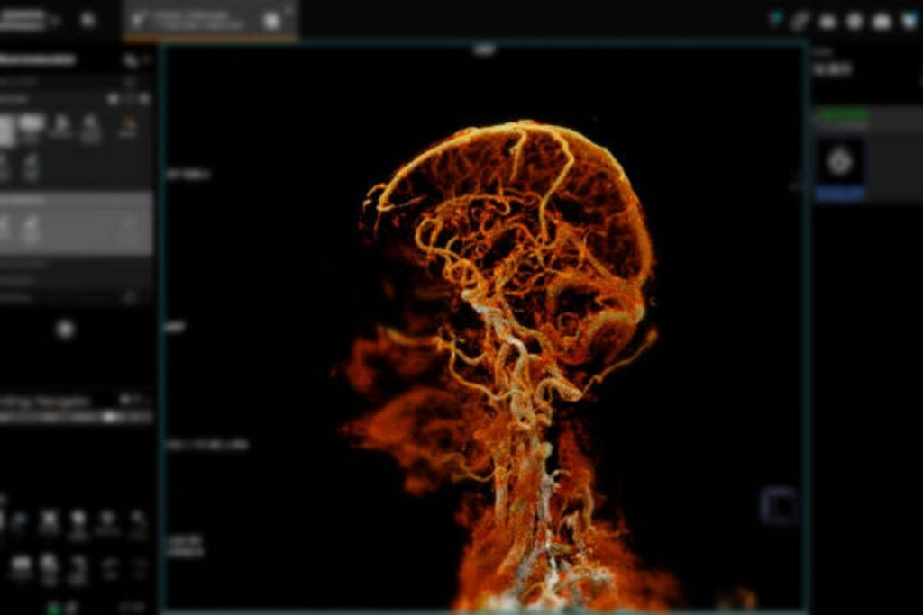 La inesperada puerta cerebral que abre el mundo de la consciencia