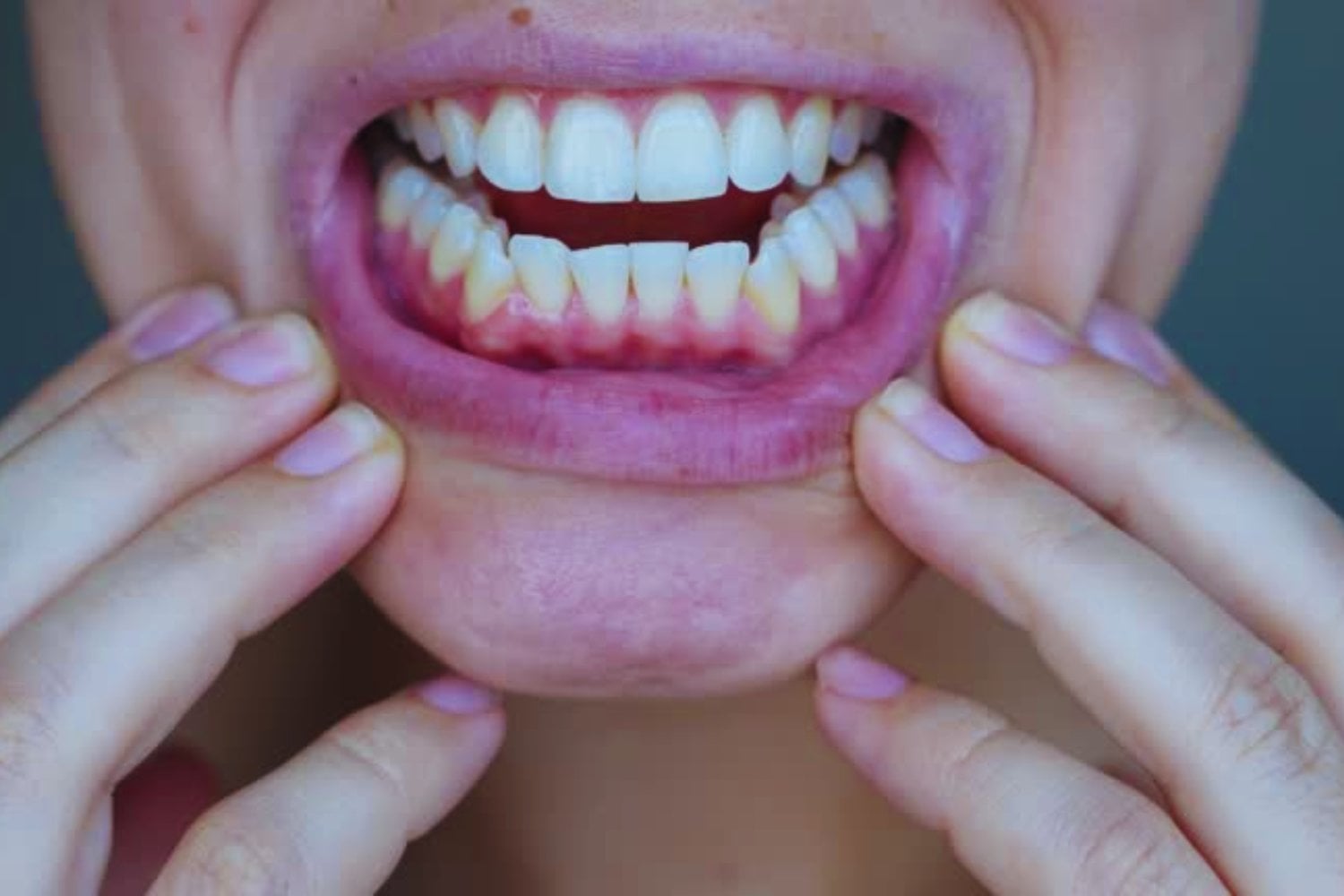 Un paso hacia el fin de los implantes: Científicos logran cultivar dientes humanos en laboratorio