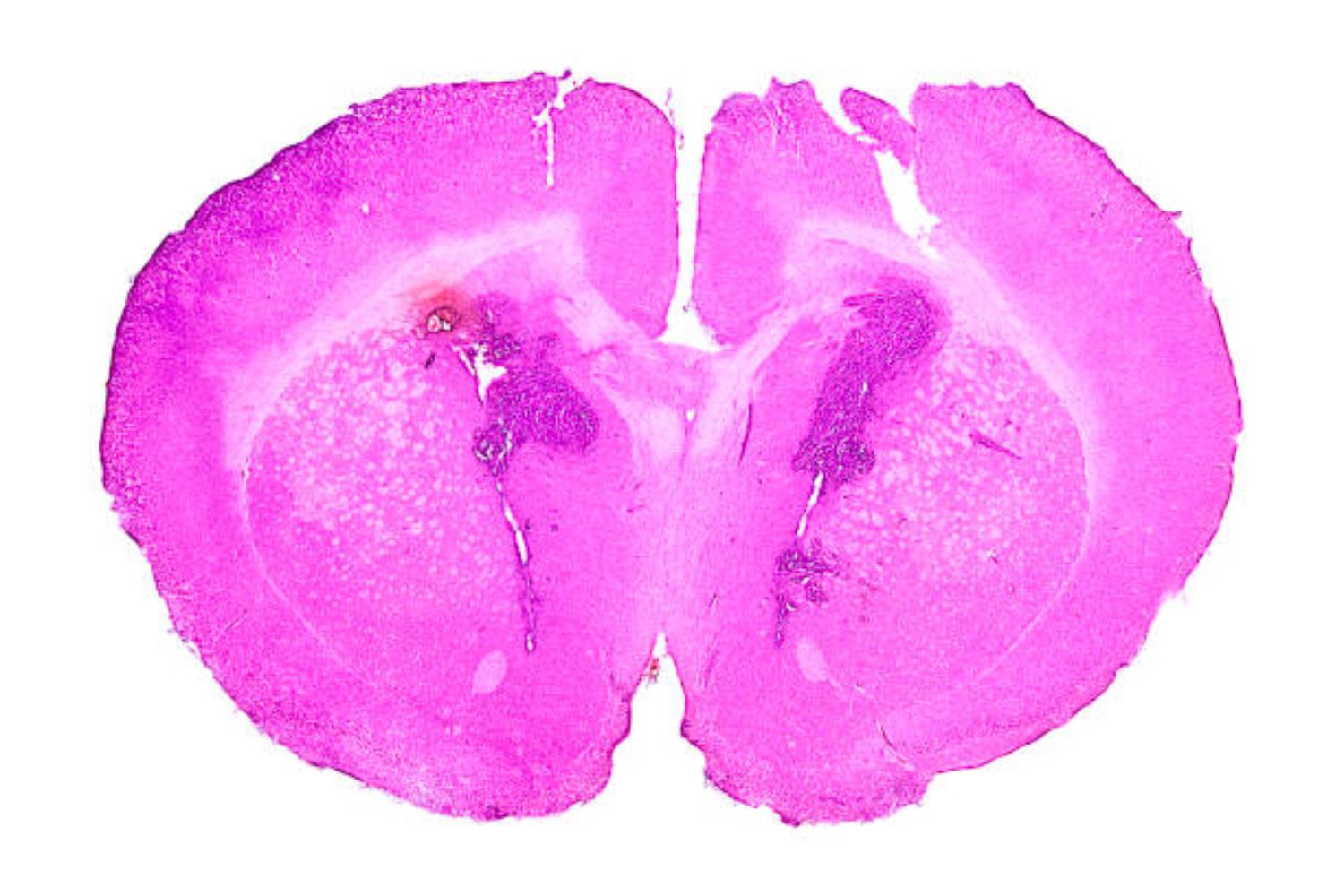 Así se está desvelando el mayor secreto del cerebro humano con la ayuda de un ratón cinéfilo