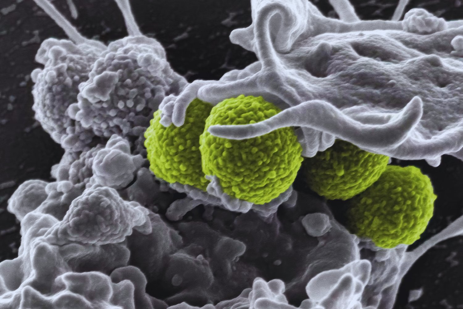 Una bacteria jamás vista en la Tierra aparece en la estación espacial china: ¿nació en el espacio?
