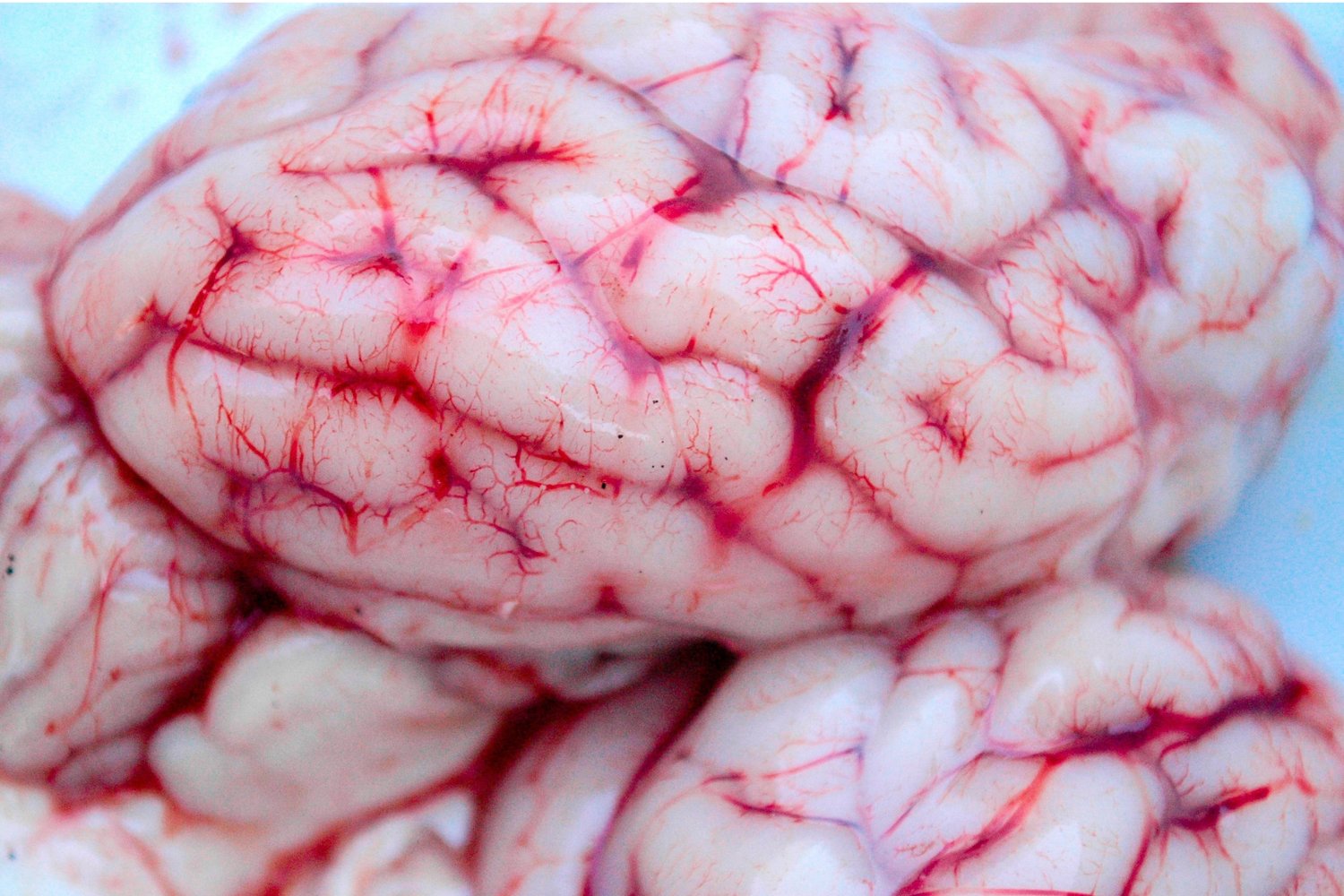 El sorprendente enigma del cerebro humano: ¿por qué empezó a encogerse?