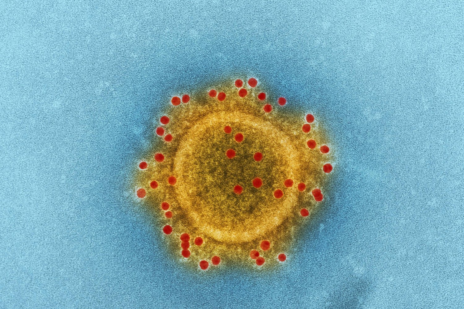 ¿Y si los virus no fueran los villanos que imaginamos?