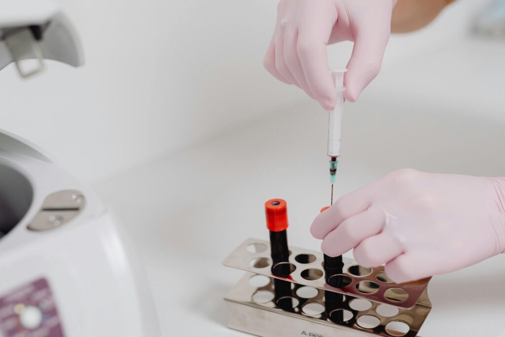 Un simple análisis que podría cambiar el destino del alzhéimer