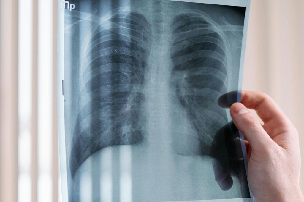 Lo que respiras también depende de lo que sentís: el estrés podría empeorar gravemente tu EPOC