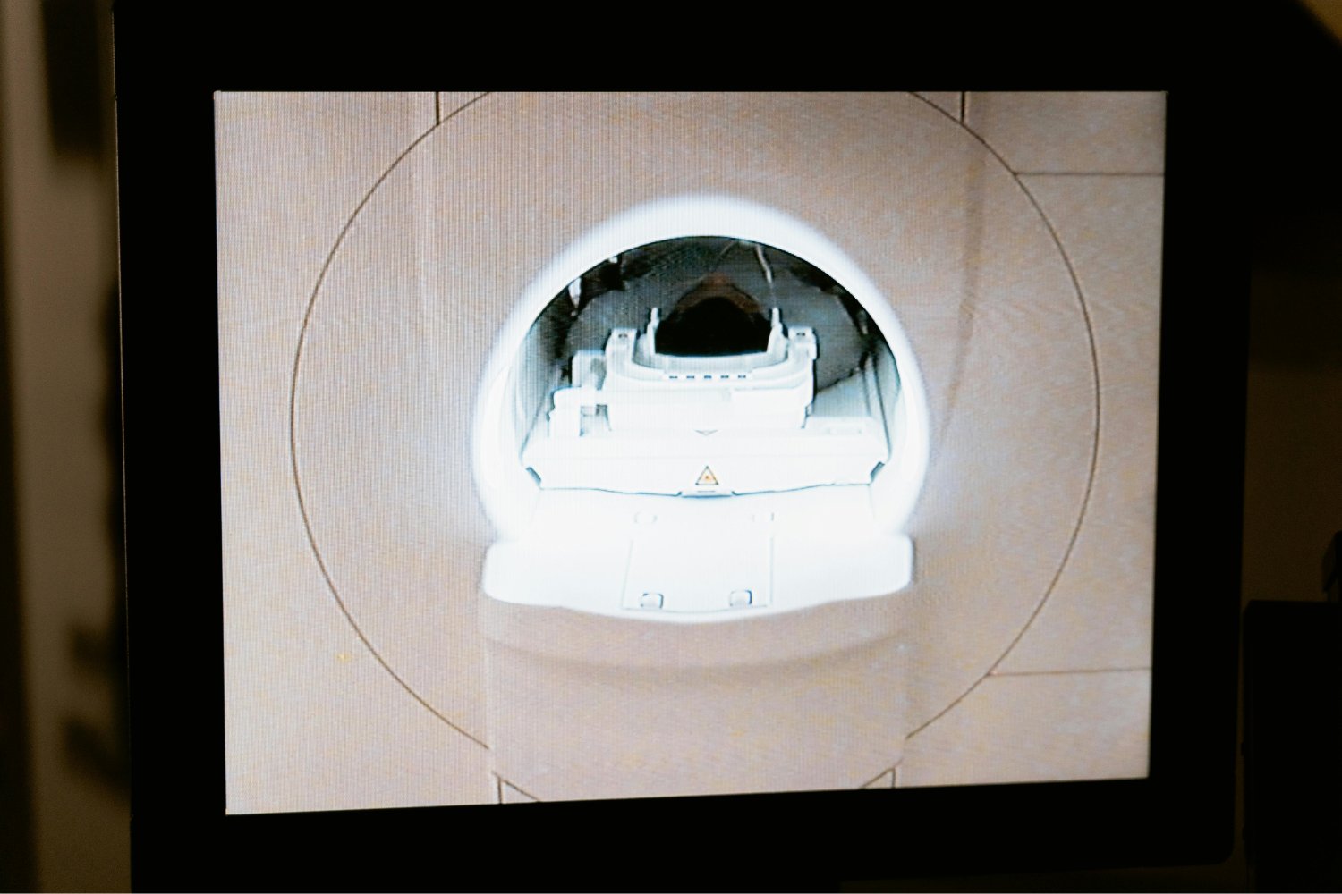 Una nueva mirada al cerebro herido: el método que podría transformar los diagnósticos traumáticos