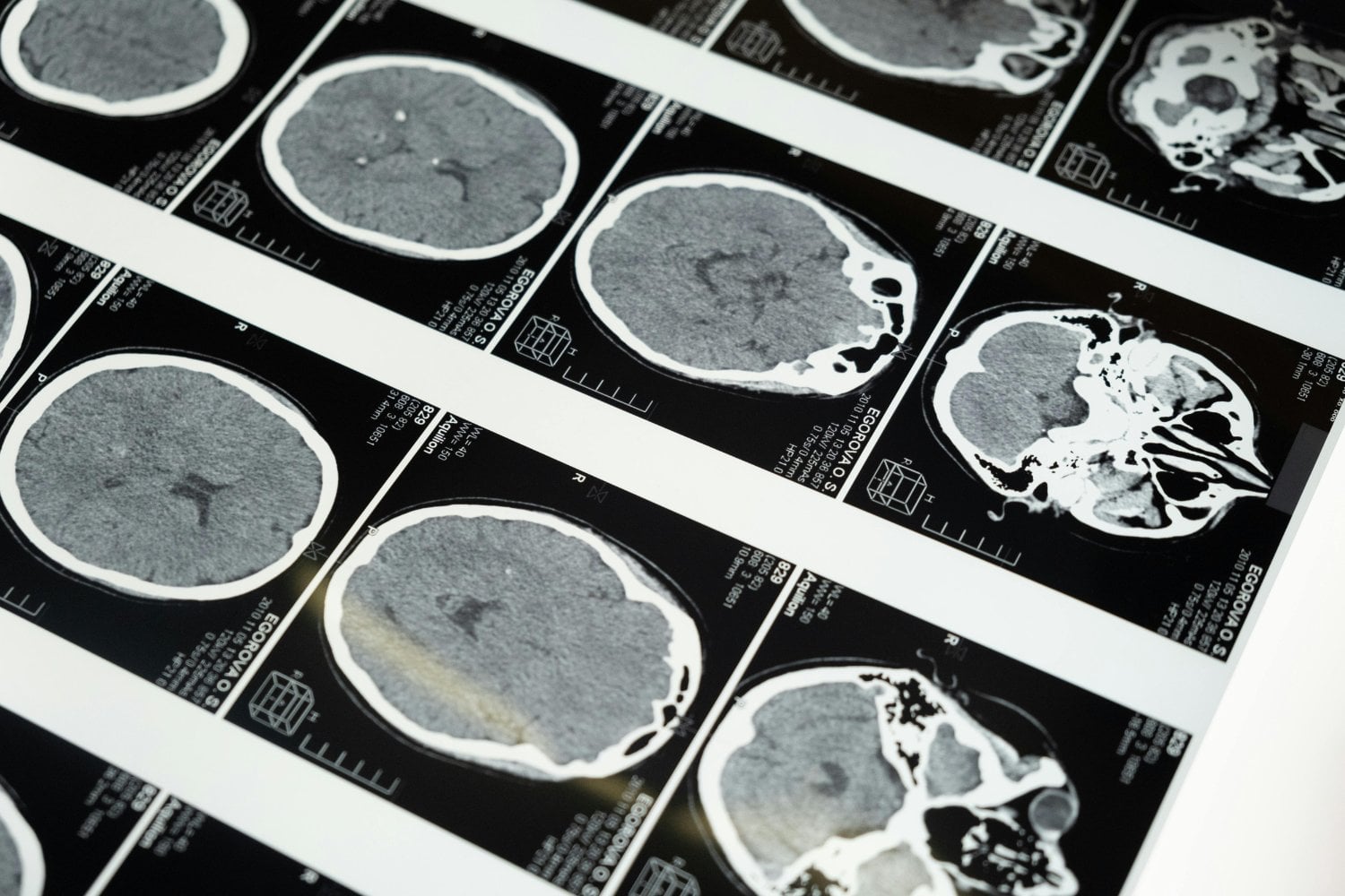 Lo que el alcohol le hace al cerebro (y no te están contando)