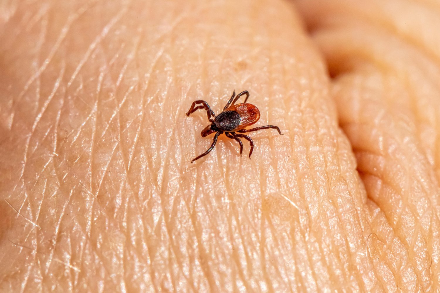 ¿Esa picadura extraña? Podría no ser lo que pensás