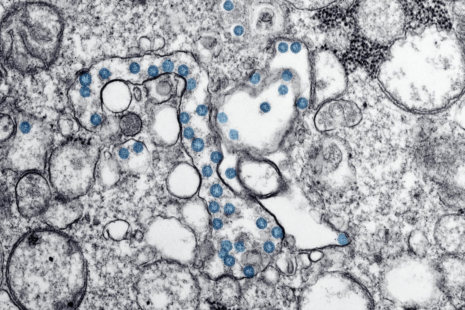 ¿Y si los antibióticos ya estaban condenados desde su invención?