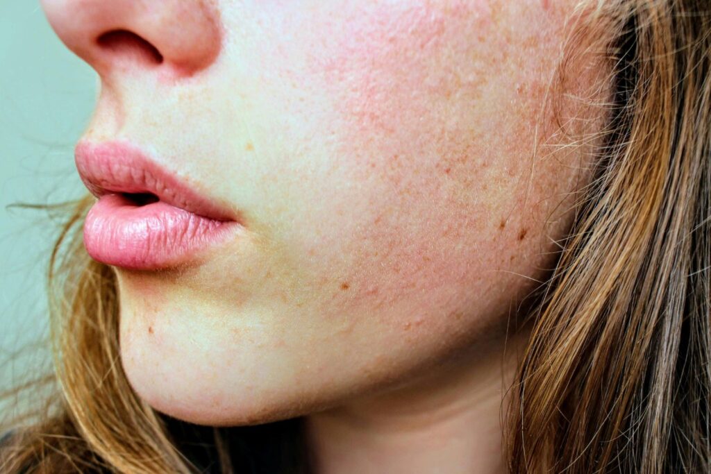 Lo que el frío le hace a tu piel y cómo evitarlo: los secretos mejor guardados del invierno