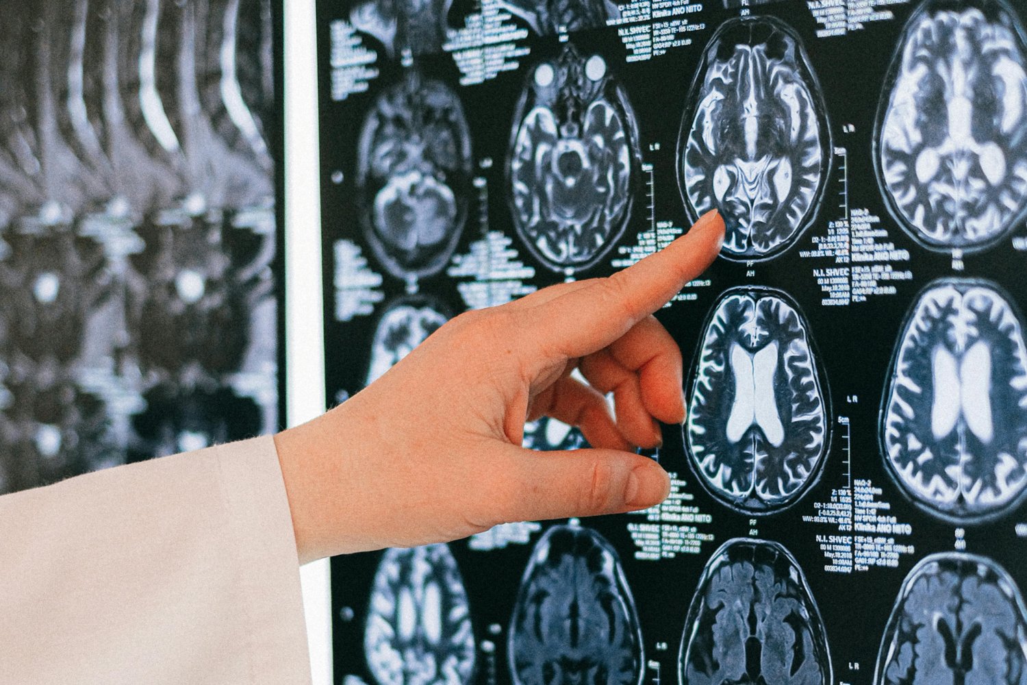 El Interruptor Social Del Cerebro