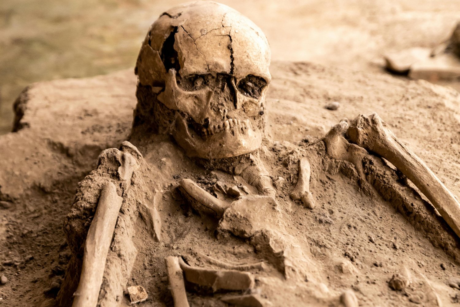 Esqueletos Encontrados En Gloucester Detienen Una Obra