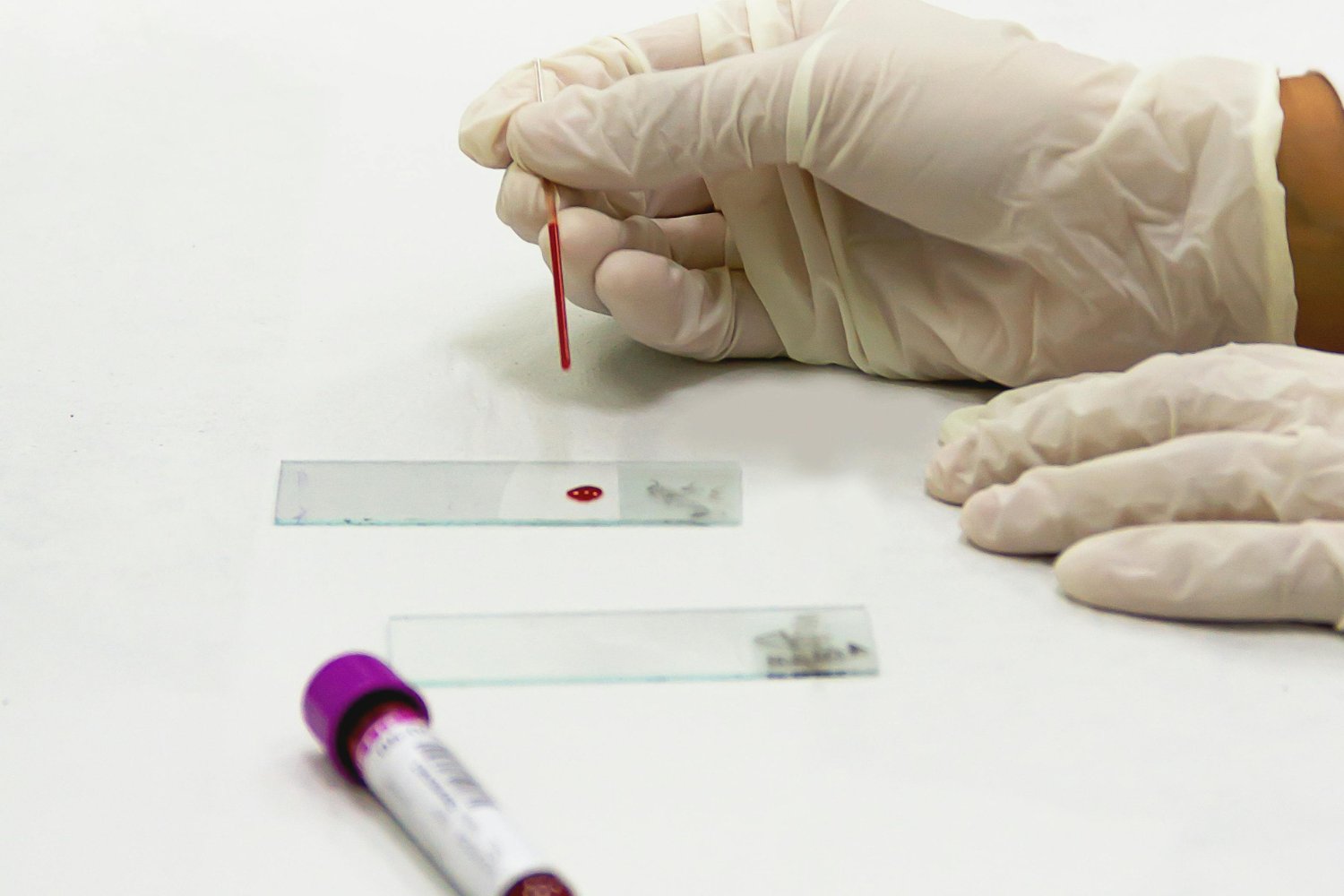 Grupos Y Factores De Sangre