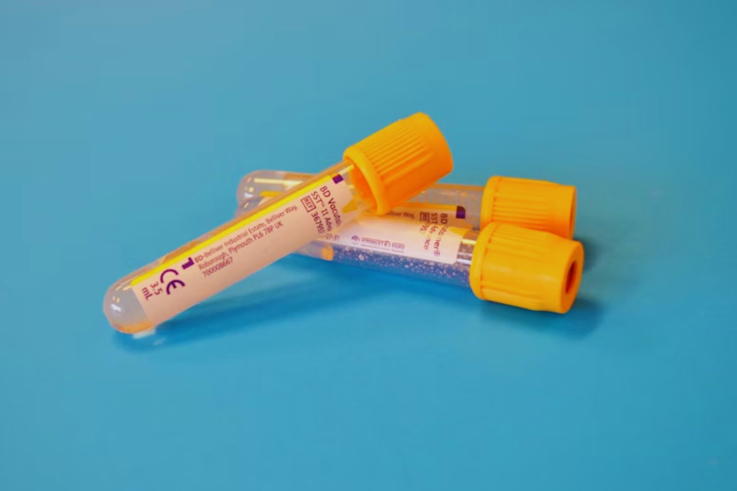 OMS recomienda nueva inyección para prevenir el VIH, pero la crisis de fondos pone en riesgo su alcance global