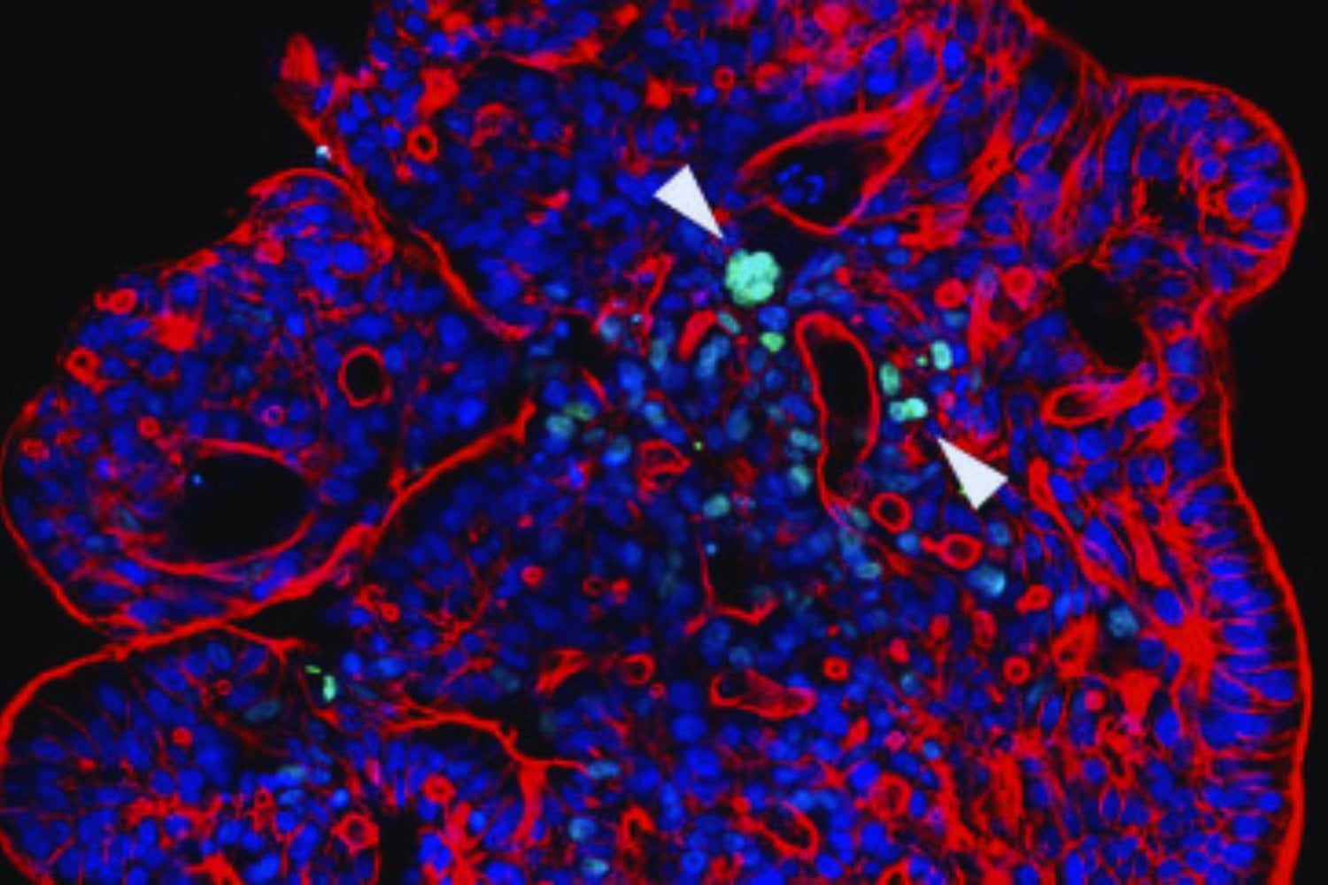 Células durmientes: el riesgo invisible que amenaza con desatar una nueva guerra mundial