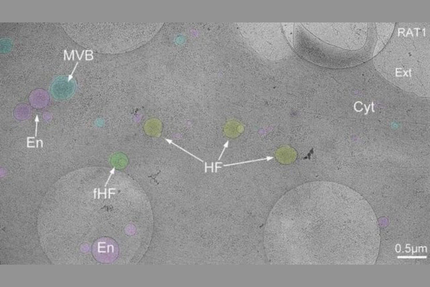 Descubren una estructura desconocida en células humanas: ¿un nuevo orgánulo?