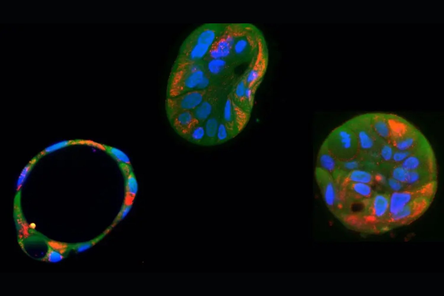 Revolución genética: la edición de ADN mitocondrial abre nuevas puertas para tratar enfermedades incurables