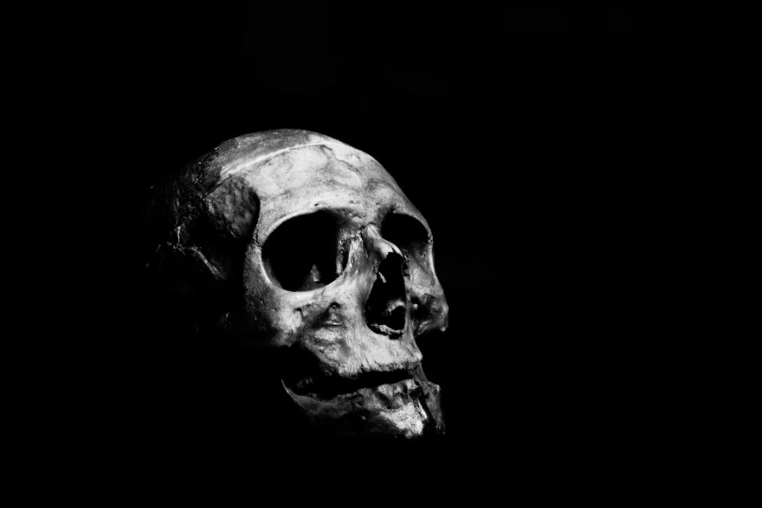 Un eco en el cráneo: pistas neandertales tras una malformación cerebral moderna