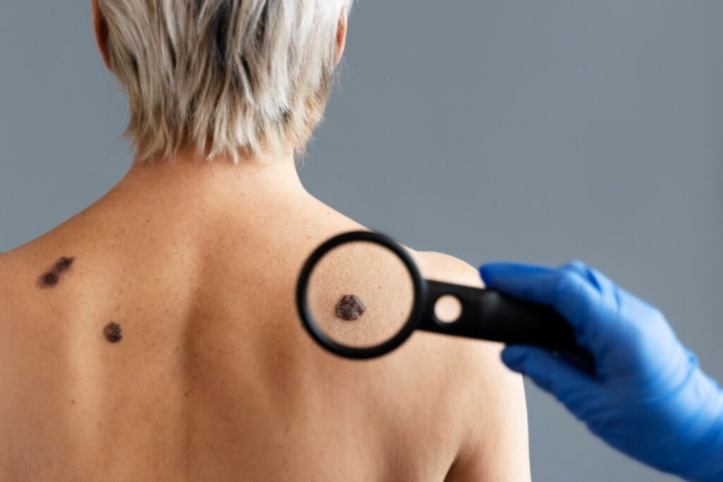 Lo que está aumentando entre los jóvenes sin que muchos se den cuenta