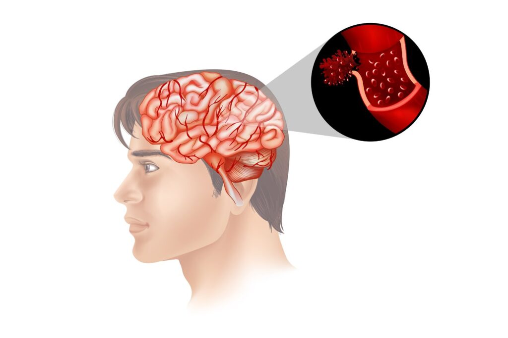 Lo que respiras podría estar afectando a tu cerebro más de lo que imaginas