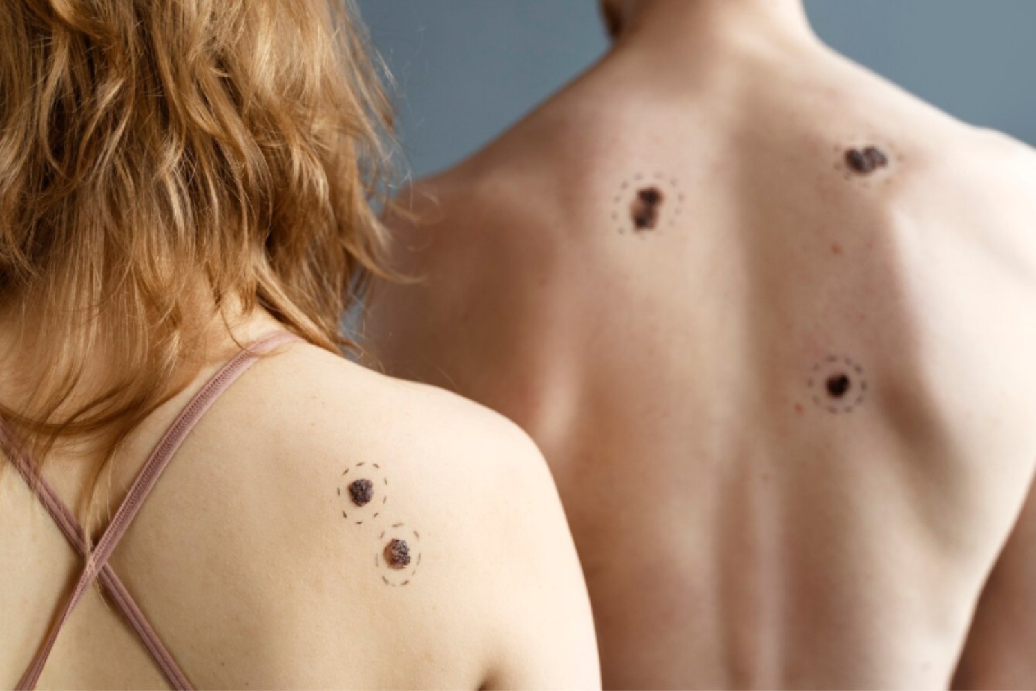 Lo que está aumentando entre los jóvenes sin que muchos se den cuenta