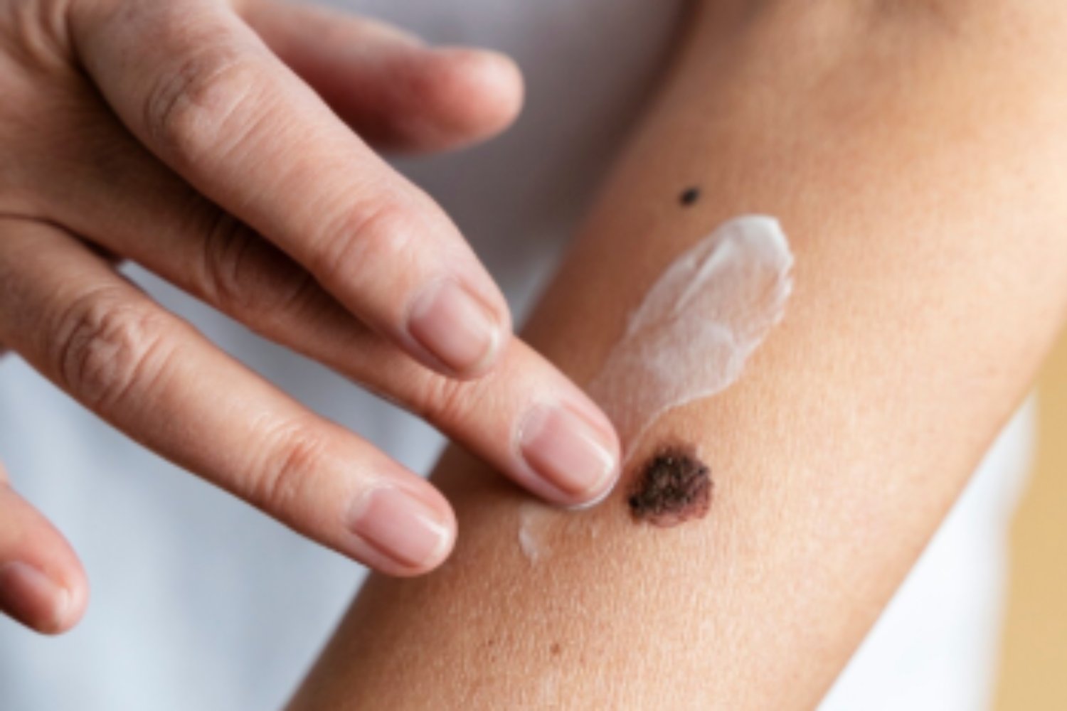 Lo que está aumentando entre los jóvenes sin que muchos se den cuenta