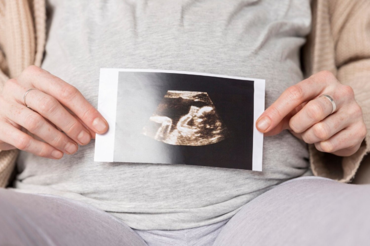 El duelo invisible que decide la vida antes de nacer