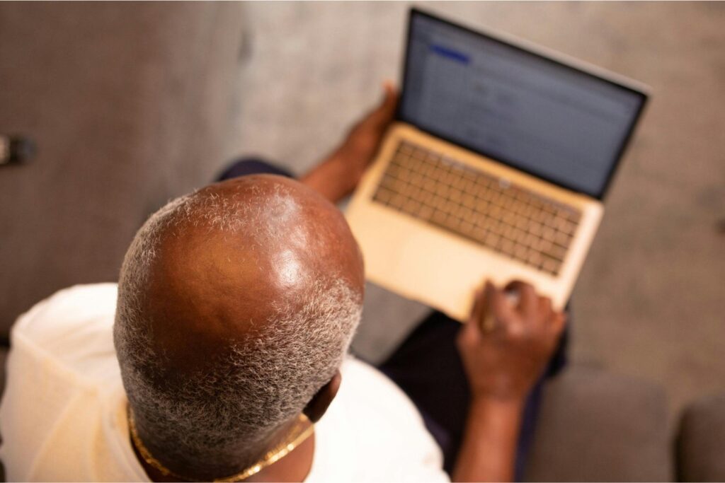 El fármaco que podría enterrar al minoxidil y revolucionar la lucha contra la calvicie