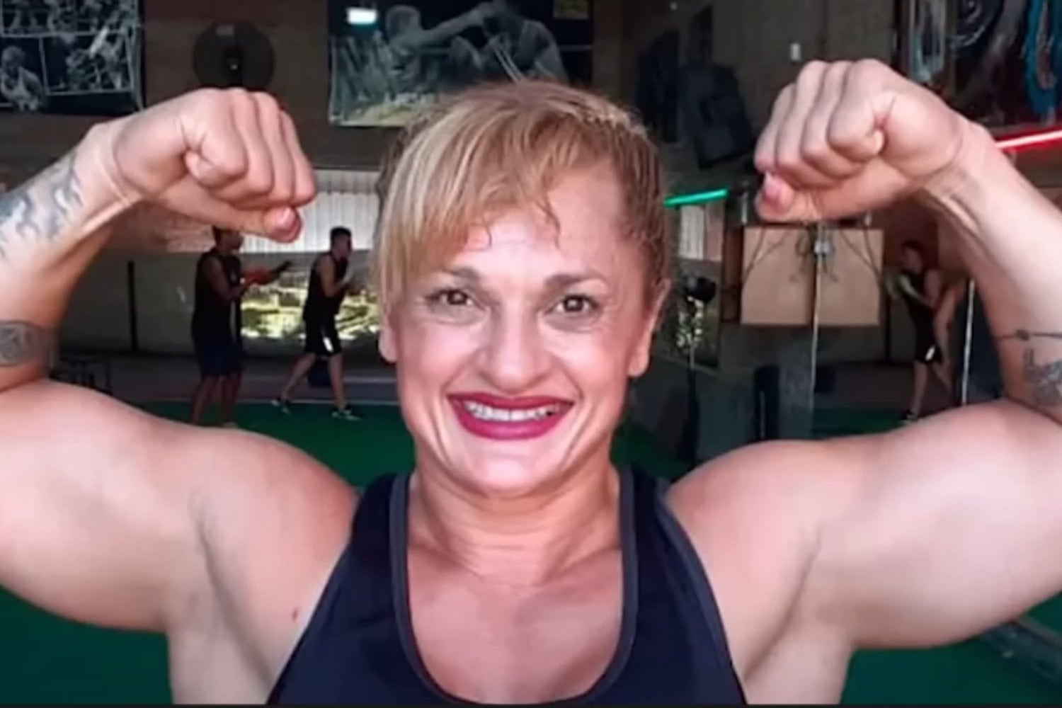 Actualizacion Del Estado De Salud De Locomotora Olivera