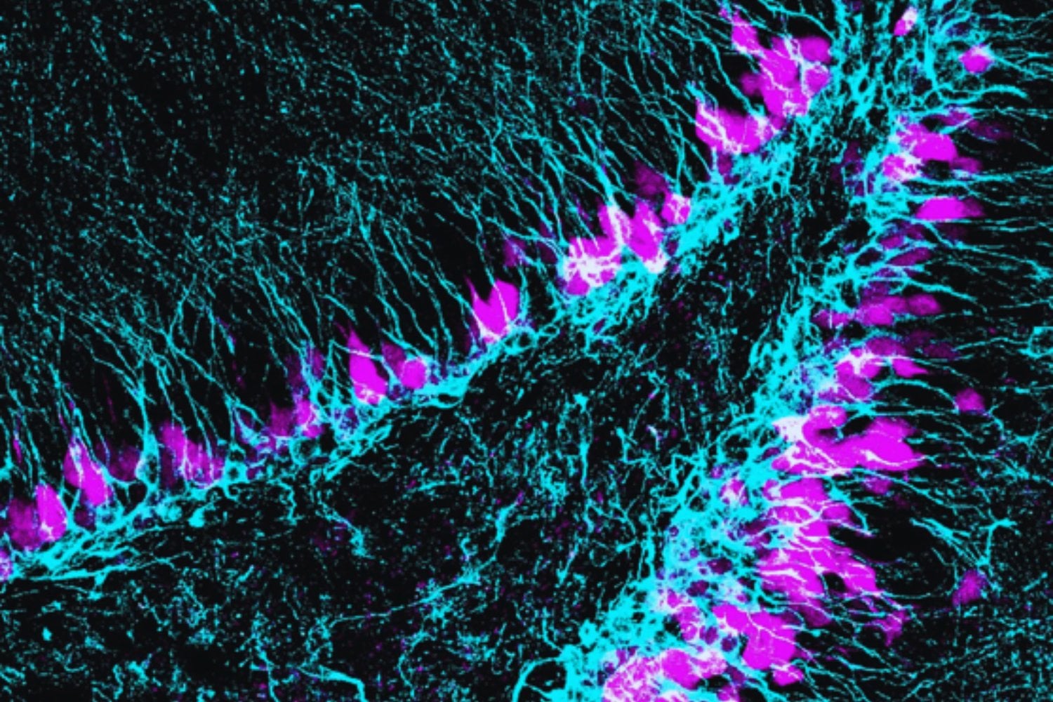 El gen que protege la reserva de células madre del cerebro adulto