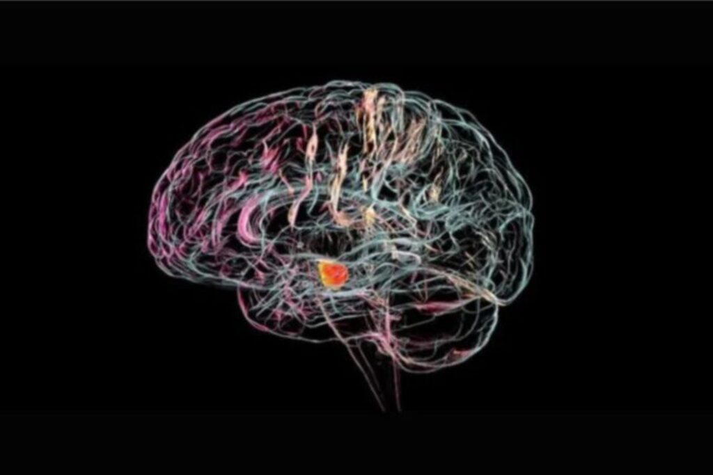 El marcapasos cerebral que devolvió la alegría tras décadas de depresión