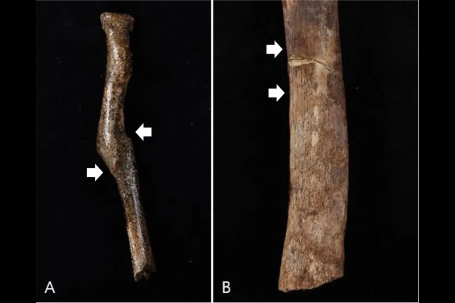 El enigma de los sacrificios sunjang: lo que la arqueología revela sobre la antigua Corea