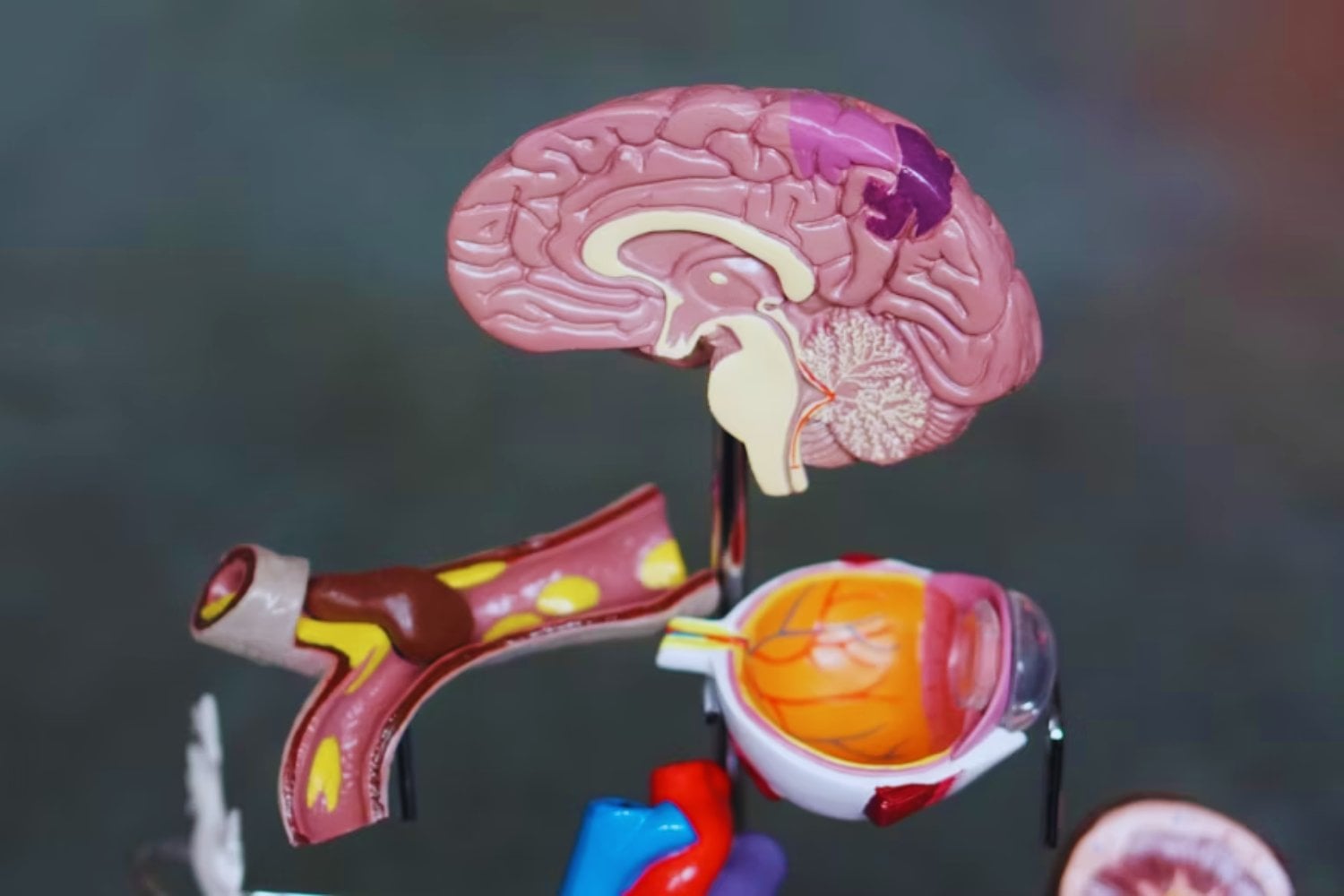 El cuerpo avisa del alzhéimer mucho antes que el cerebro: la pista está en el intestino