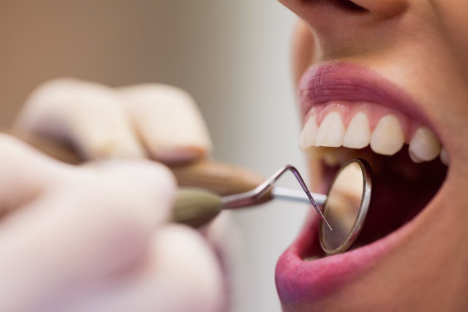 Marruecos quiere ser la nueva meca del turismo dental: viajes con sonrisa incluida