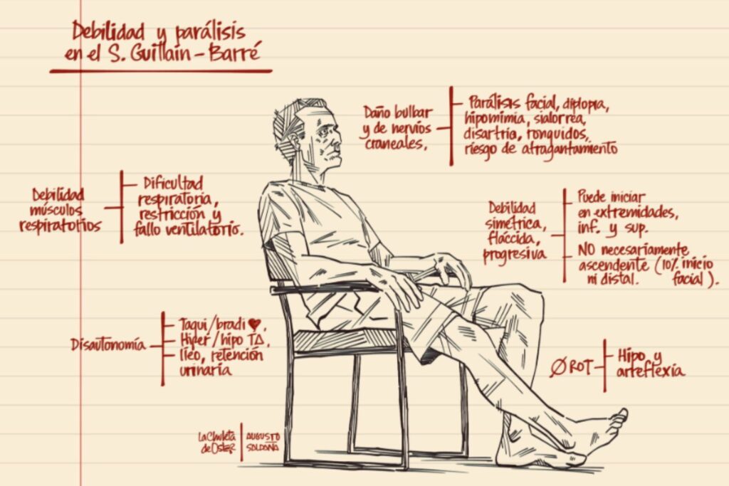 Síndrome de Guillain-Barré: la enfermedad rara que puede paralizar el cuerpo en cuestión de horas