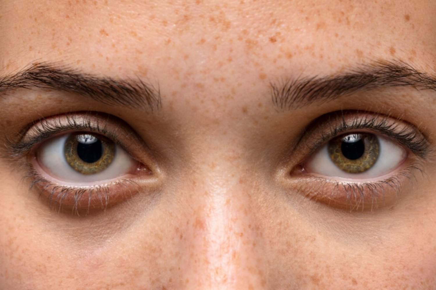 Sin cortes y en solo un minuto: la técnica que podría jubilar al LASIK